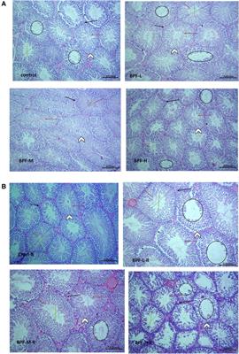 In vivo exposure to bisphenol F induces oxidative testicular toxicity: role of Erβ and p53/Bcl-2 signaling pathway